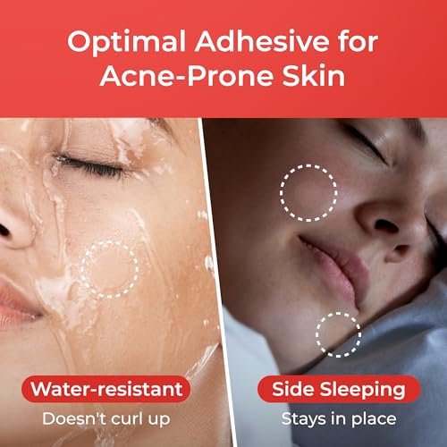 Sosky Pimple Patches for Face, 0.01 Invisible+ Hydrocolloid Acne Patches, Zit St... - Image 5