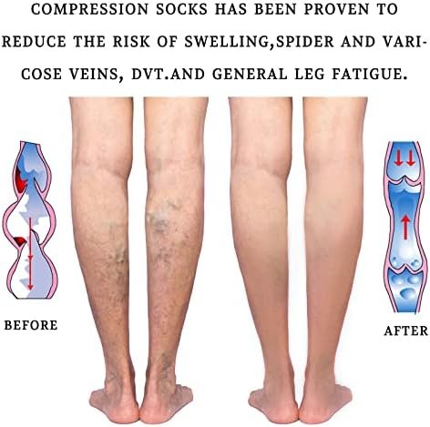 Lin Performance Medical Calf Compression Sleeve for Women and Men Lightweight Fo... - Image 6